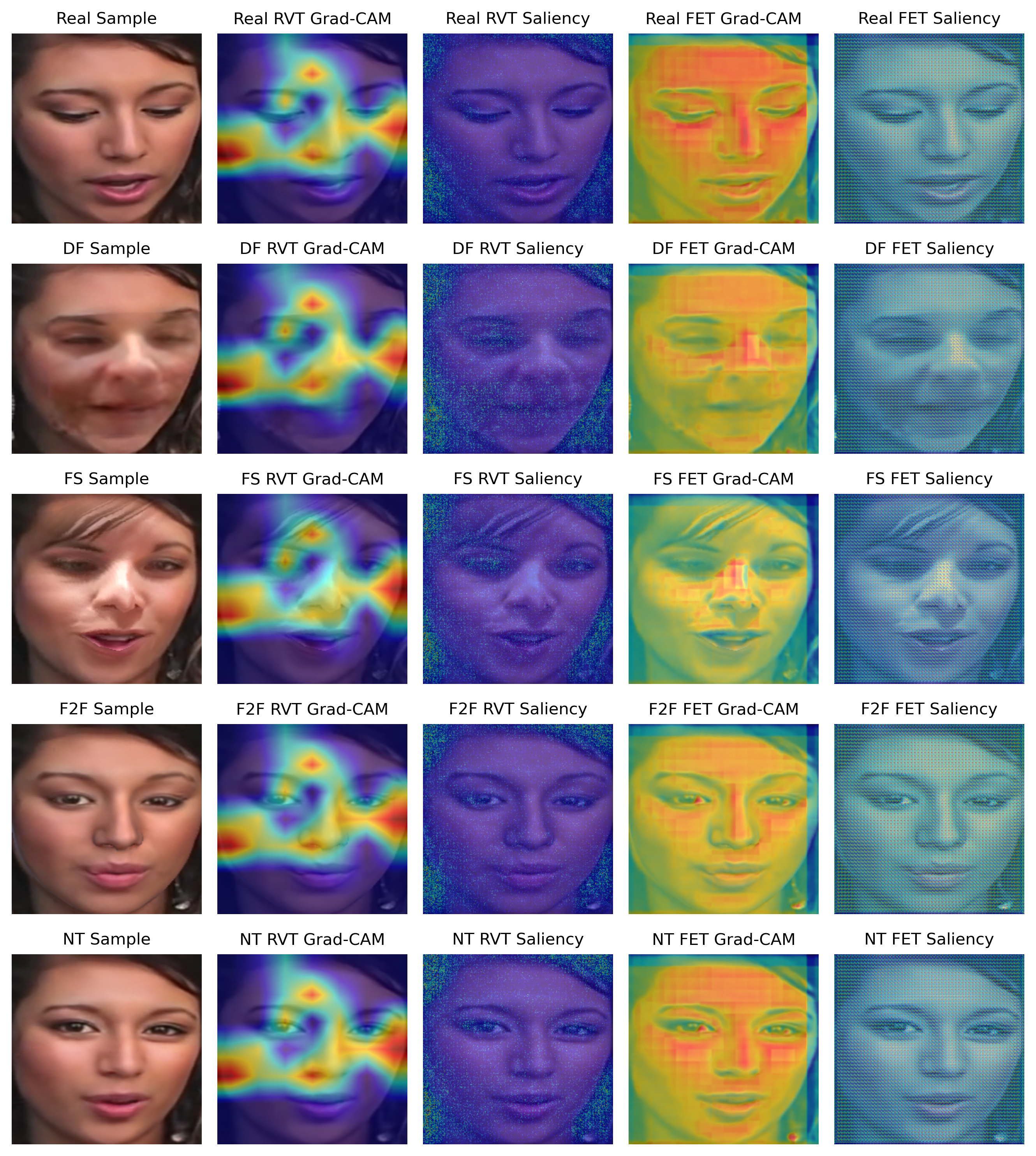 Fig. 5 — RVT vs FET interpretability